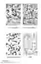 Fig. 04 - Allogeneic tumor cell vaccination