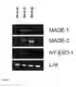 Fig. 06 - Allogeneic tumor cell vaccination