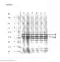 Fig. 09 - VACCINE COMPOSITION