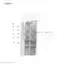 Fig. 14 - VACCINE COMPOSITION