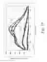 Fig. 50 - Systems, Methods, and Compositions For Cross-Linking Treatments of an Eye