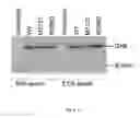 Fig. 05 - METHODS AND COMPOSITIONS FOR MODULATING SIALIC ACID PRODUCTION AND TREATING HEREDITARY INCLUSION BODY MYOPATHY