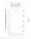 Fig. 11 - METHODS AND COMPOSITIONS FOR MODULATING SIALIC ACID PRODUCTION AND TREATING HEREDITARY INCLUSION BODY MYOPATHY