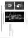 Fig. 12 - Pet imaging of zinc transport