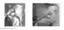 Fig. 01 - Solid forms for tissue repair
