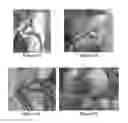 Fig. 03 - Solid forms for tissue repair
