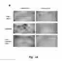 Fig. 02 - COMBINATION THERAPY TO PROMOTE WOUND HEALING