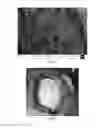 Fig. 04 - TISSUE REPAIR SCAFFOLD AND PREPARATION METHOD AND PURPOSE THEREOF