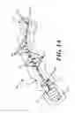 Fig. 02 - Methods and devices for applying closed incision negative pressure wound therapy