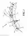 Fig. 04 - Methods and devices for applying closed incision negative pressure wound therapy