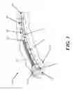 Fig. 05 - Methods and devices for applying closed incision negative pressure wound therapy