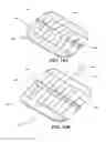 Fig. 17 - Methods and devices for applying closed incision negative pressure wound therapy