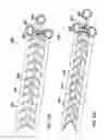 Fig. 23 - Methods and devices for applying closed incision negative pressure wound therapy