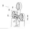 Fig. 24 - Methods and devices for applying closed incision negative pressure wound therapy