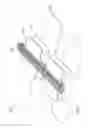 Fig. 29 - Methods and devices for applying closed incision negative pressure wound therapy