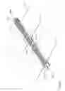 Fig. 31 - Methods and devices for applying closed incision negative pressure wound therapy