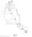 Fig. 04 - Guidewire system and method of pump installation using same