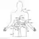 Fig. 01 - Implantable connector