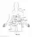 Fig. 17 - Implantable connector