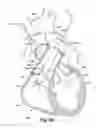 Fig. 10 - Blood pump