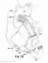 Fig. 13 - Blood pump