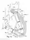Fig. 14 - Blood pump