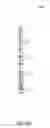 Fig. 83 - HEMODIALYSIS SYSTEMS AND METHODS