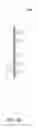 Fig. 96 - HEMODIALYSIS SYSTEMS AND METHODS
