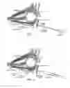 Fig. 02 - METHODS OF PERFORMING RETROBULBAR INJECTIONS