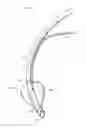 Fig. 01 - Endotracheal cuff and technique for using the same