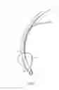 Fig. 02 - Endotracheal cuff and technique for using the same