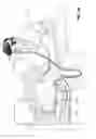 Fig. 03 - Heat and moisture exchanger for a patient interface