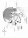 Fig. 09 - Heat and moisture exchanger for a patient interface