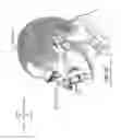 Fig. 10 - Heat and moisture exchanger for a patient interface