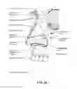 Fig. 14 - Heat and moisture exchanger for a patient interface
