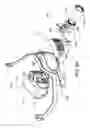 Fig. 32 - Heat and moisture exchanger for a patient interface
