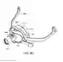 Fig. 34 - Heat and moisture exchanger for a patient interface