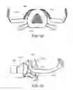 Fig. 35 - Heat and moisture exchanger for a patient interface