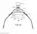 Fig. 36 - Heat and moisture exchanger for a patient interface
