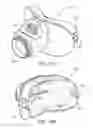 Fig. 47 - Heat and moisture exchanger for a patient interface