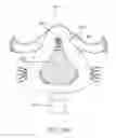 Fig. 52 - Heat and moisture exchanger for a patient interface