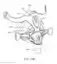 Fig. 53 - Heat and moisture exchanger for a patient interface