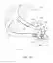Fig. 57 - Heat and moisture exchanger for a patient interface