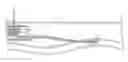 Fig. 01 - Catheter patency systems and methods
