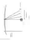 Fig. 04 - Catheter placement device