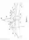 Fig. 04 - Cutting balloon catheter