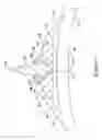 Fig. 05 - Cutting balloon catheter