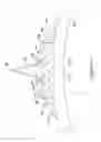 Fig. 06 - Cutting balloon catheter