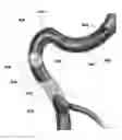 Fig. 01 - DEVICE FOR TREATING VASCULAR OCCLUSION