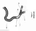 Fig. 02 - DEVICE FOR TREATING VASCULAR OCCLUSION